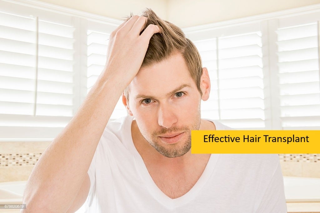 Effective Hair Transplant