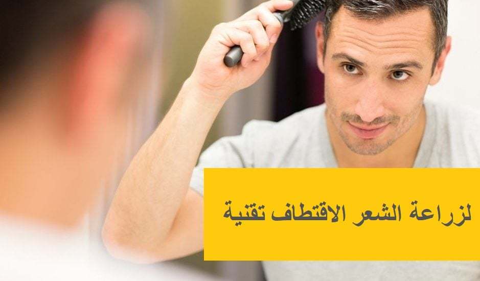 FUE-Saç-Ekimi-Tekniği-1-939x550