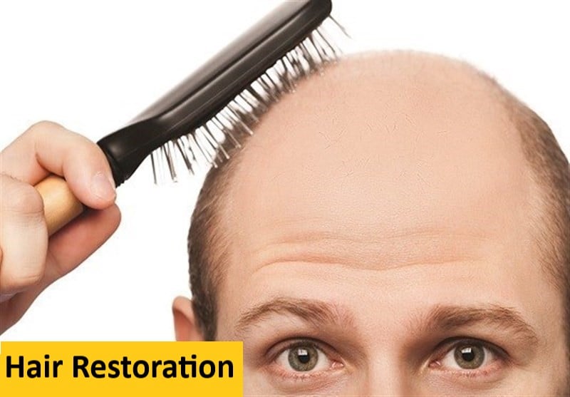 Hair Restoration