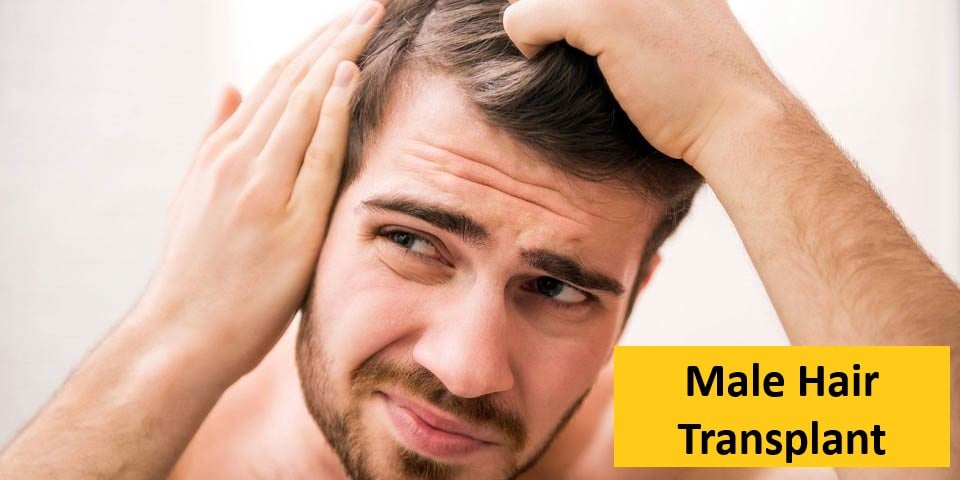 Male Hair Transplant