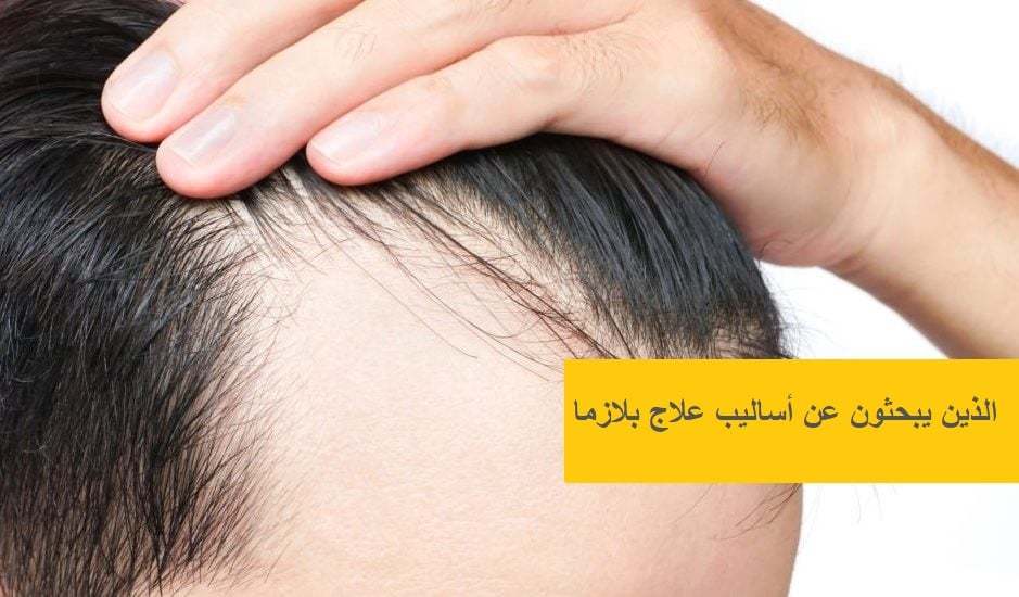 PRP-Yöntemi-İle-İlgili-Merak-Edilenler-939x550