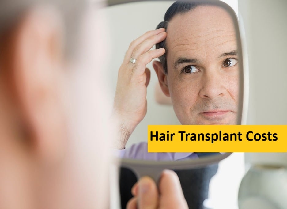 Hair Transplant Costs