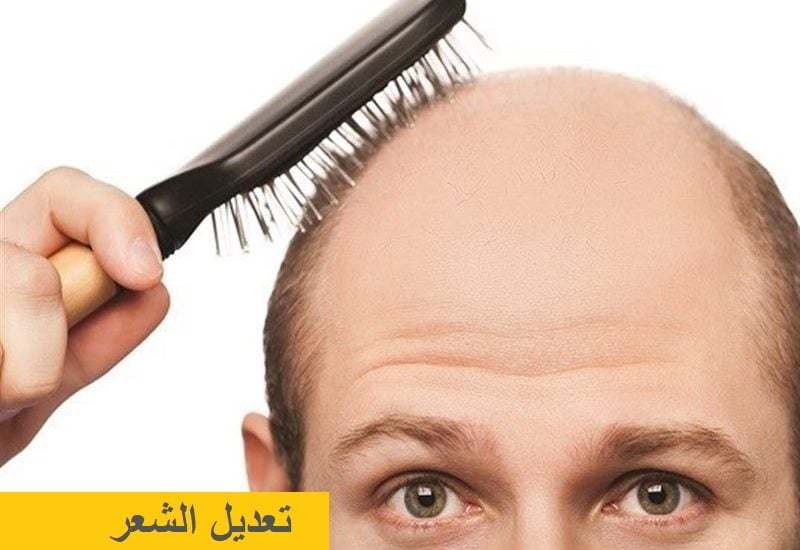 Saç-Restorasyonu-800x550